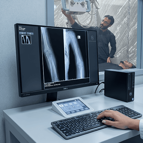 X-Ray